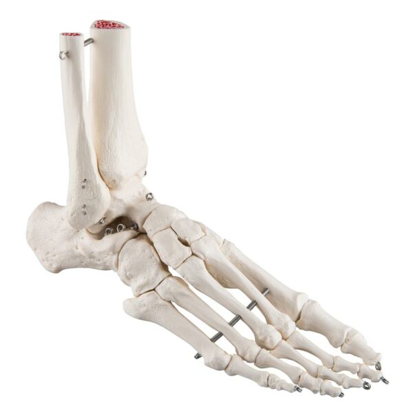 Voet / gedeelde tibia en fibula A31