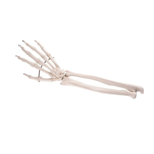 Hand+ulna/radius A41