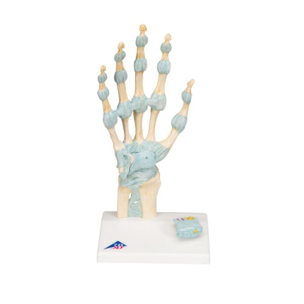 Hand met banden en carpale tunnel M33