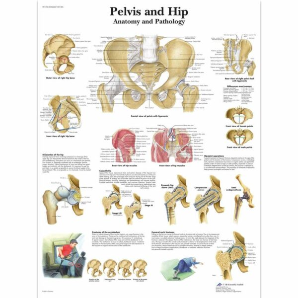 Poster Pelvis and hip gelamineerd