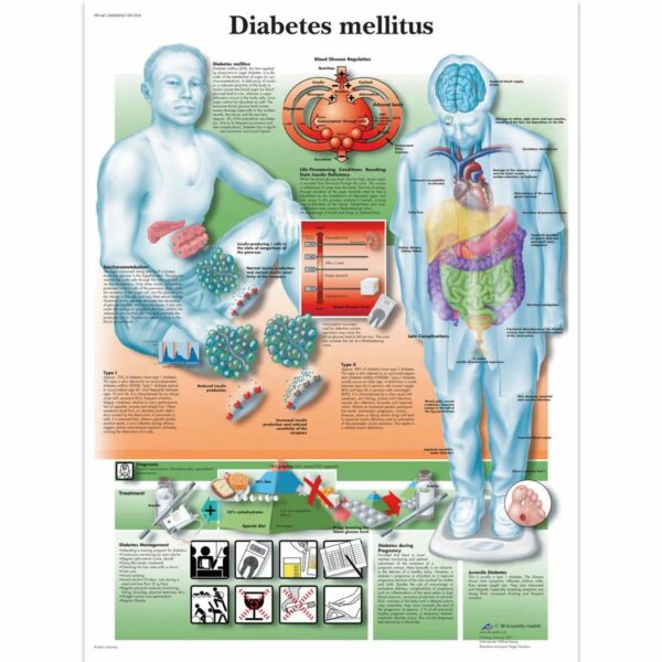 Poster Diabetes Mellitus gelamineerd