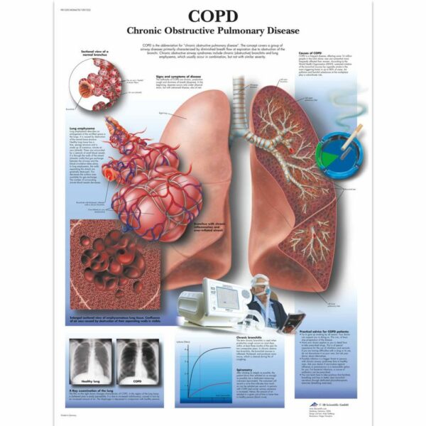Poster COPD gelamineerd